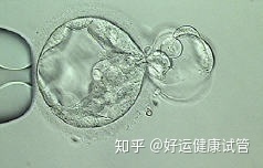 三代試管知男女的必經之路—胚胎活檢術(圖4)