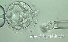 三代試管知男女的必經之路—胚胎活檢術(圖6)