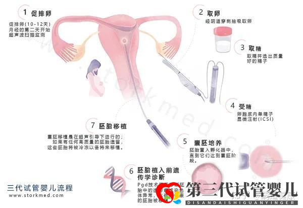 這張《第三代試管嬰兒流程圖》,一目了然(圖1)