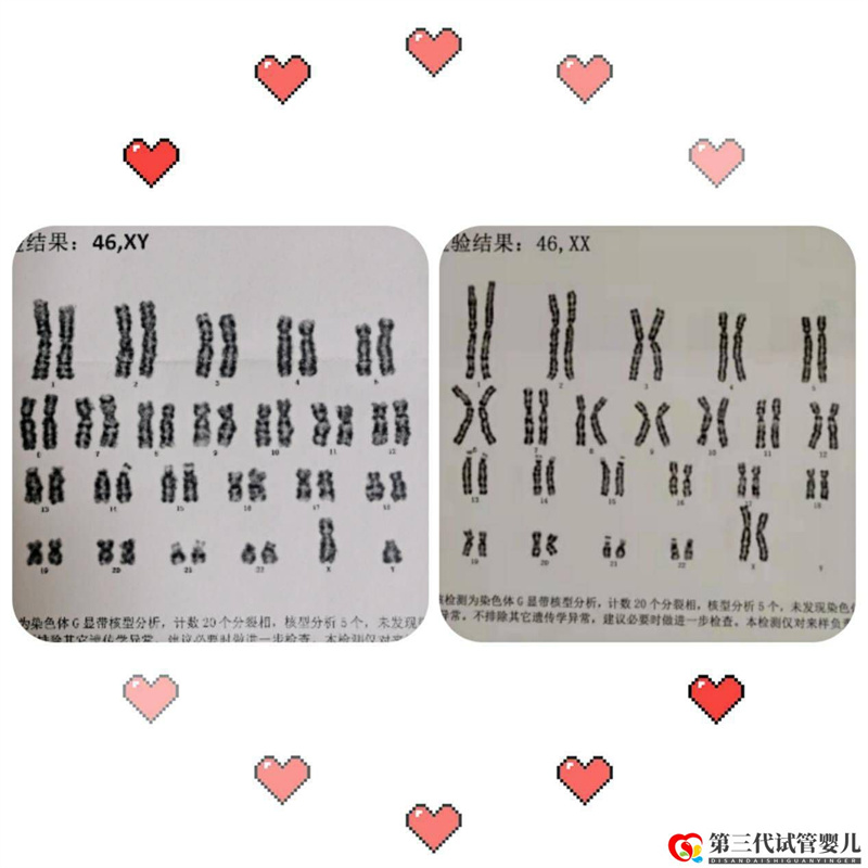 為什么父母染色體正常，胚胎染色體卻有問題？(圖1)