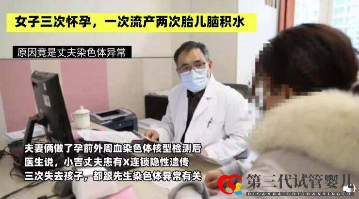 女子三次懷孕一次流產兩次胎兒腦積水原因竟是丈夫染色體異常(圖2)