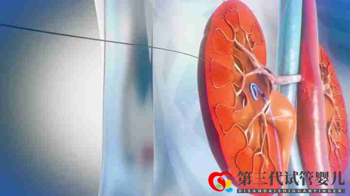醫學三維動畫可以解決哪些問題(圖1)
