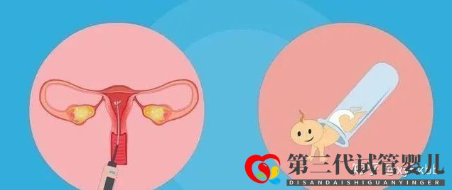 國內第三代試管嬰兒可以選擇性別嗎心悅告訴你(圖2)