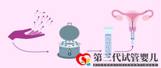 人授還是試管應該怎么選(圖1)