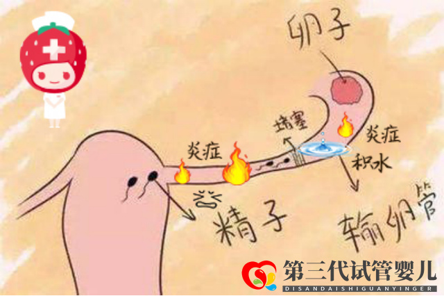 報喜萬家！輸卵管積水的她放棄做試管，卻憑一劑中藥喜獲“好孕”(圖1)