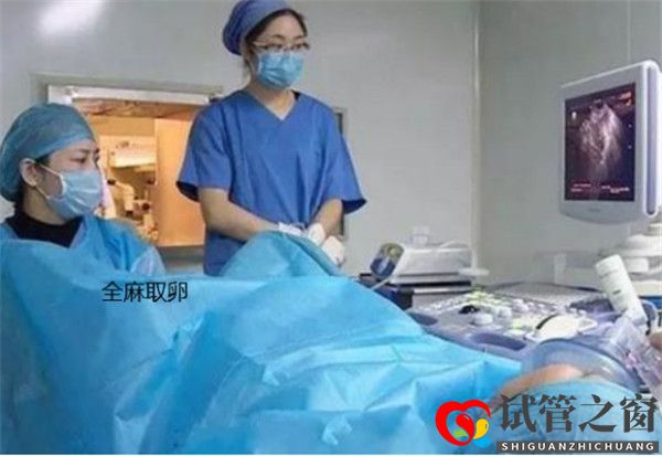 關于試管嬰兒全麻取卵的常見知識有哪些(圖1)