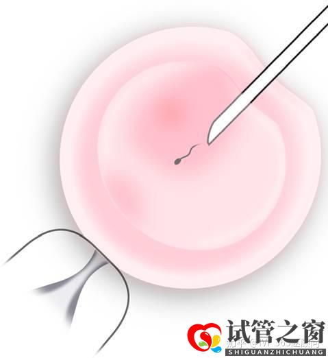 關于試管嬰兒,你想知道的都在這里,不懂就得多看看(圖2)