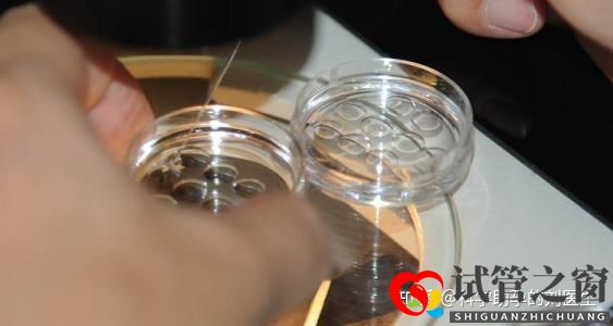 做試管嬰兒的全過程做三代試管嬰兒預備10萬夠不夠(圖2)