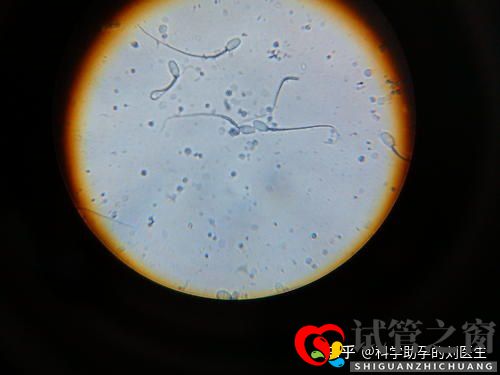 做試管嬰兒的全過程做三代試管嬰兒預備10萬夠不夠(圖8)