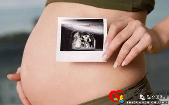 高齡選擇做第三代試管嬰兒注意事項有哪些？(圖2)