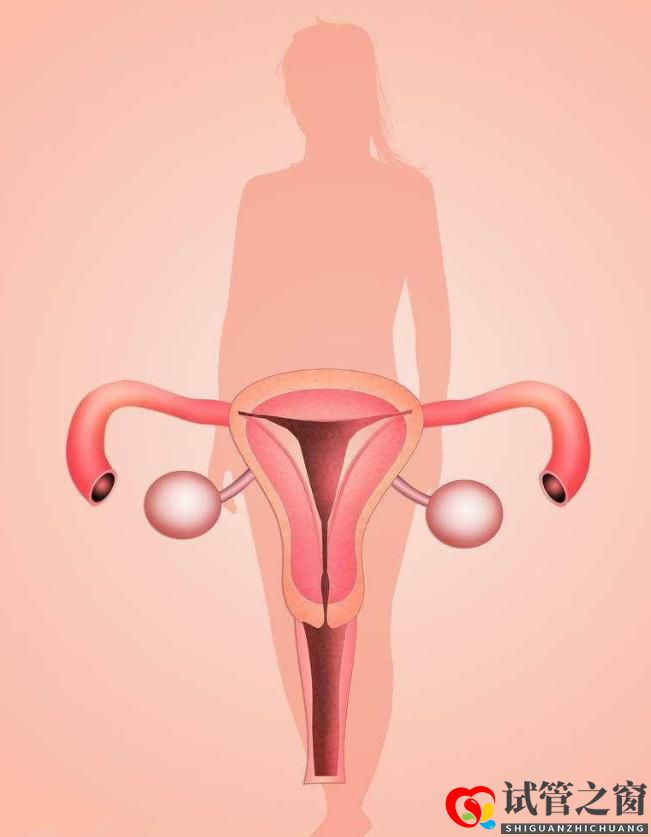 輸卵管通而不暢一定要做試管嗎？(圖1)