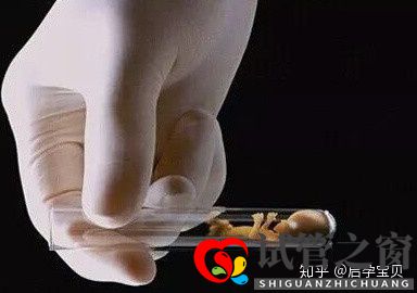 靠試管嬰兒生寶寶首先要滿足6個標準(試管嬰兒怎么做的全過程)(圖2)