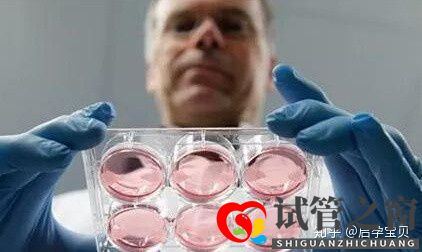 靠試管嬰兒生寶寶首先要滿足6個標準(試管嬰兒怎么做的全過程)(圖3)