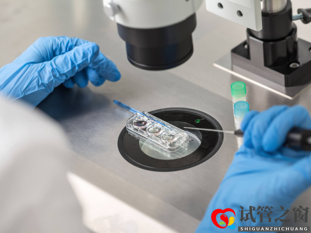 無精和死精的診斷標準不一樣