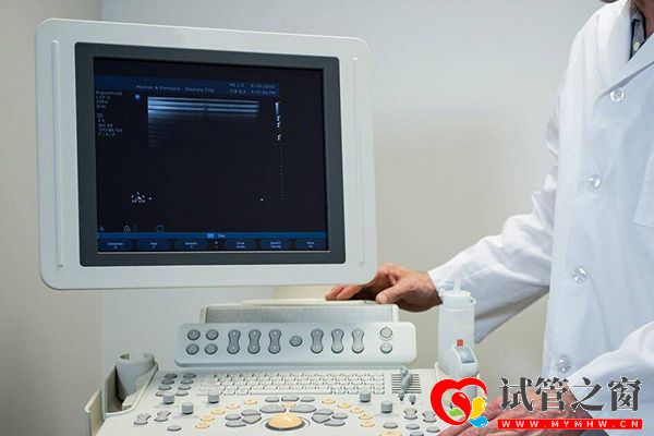 試管移植后超聲檢查胎兒發(fā)育情況