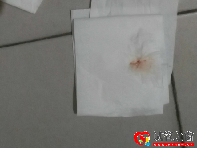 受精卵成功會(huì)少量出血