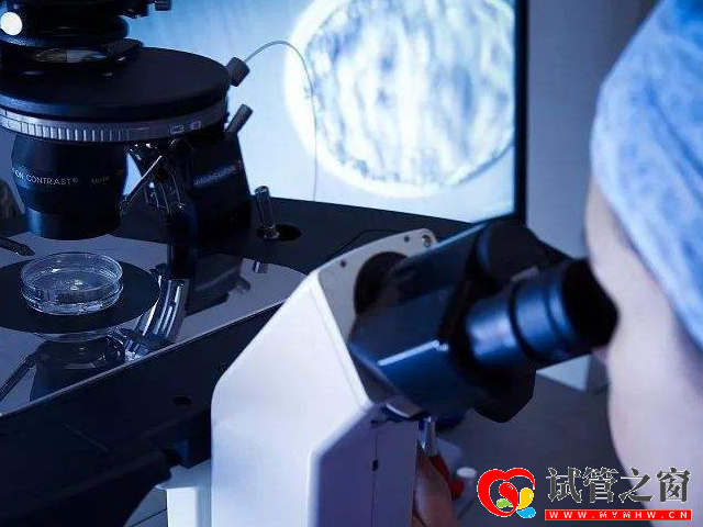 黃體期促排使用患者會經歷兩次取卵