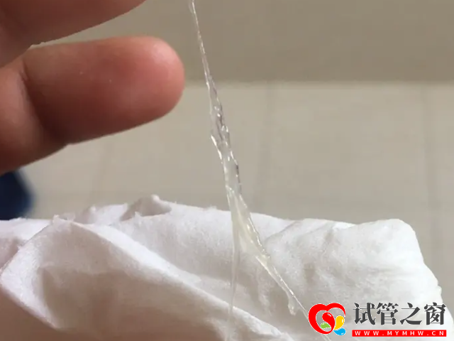 排卵期女性白帶拉絲只有兩到三天的時間