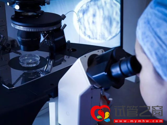 取卵手術(shù)大概15至20分鐘