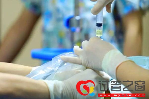 8號染色體短臂缺失后果嚴重