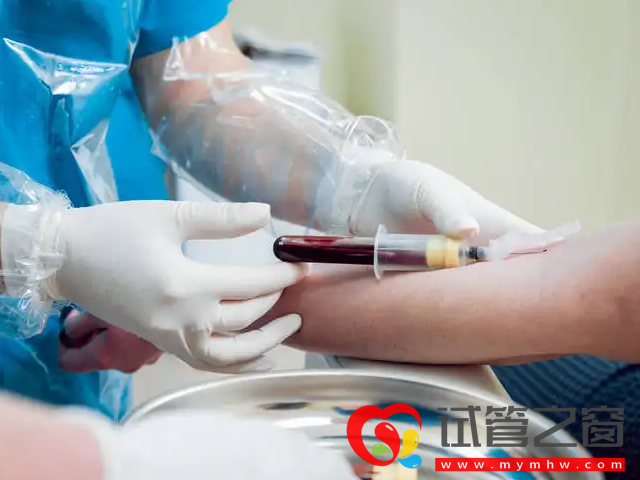 備孕檢查當(dāng)需要空腹抽血