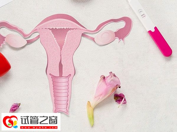 子宮內膜是否異位要做什么項目