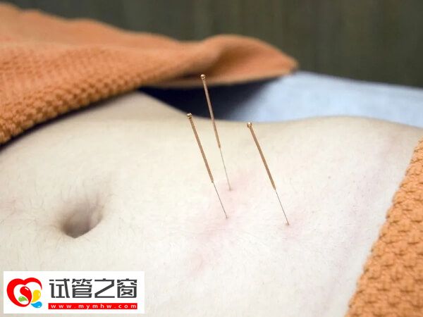 針灸可以調(diào)和陰陽