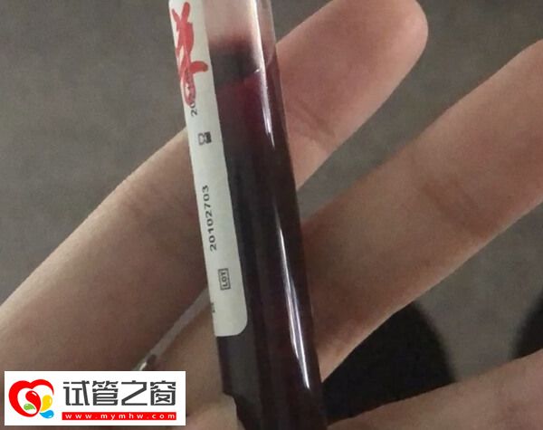 女方有糖尿病可不可以做試管嬰兒(圖1) 做試管期間要控制好血糖