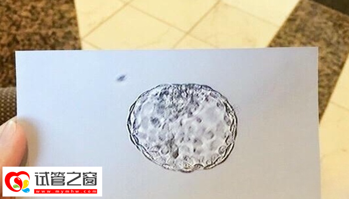 結果單顯示NAD就說明胚胎正常