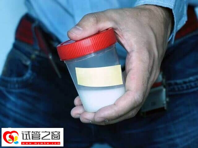 做試管嬰兒要先取精子