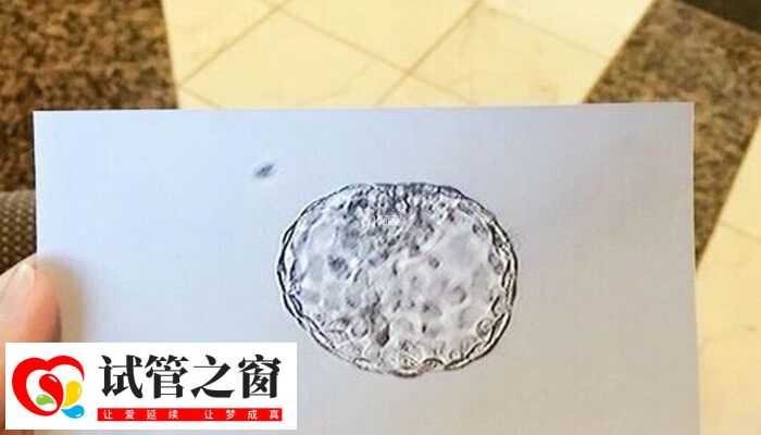 做試管嬰兒必須要有可用胚胎