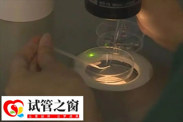 試管取卵過多可能會引起卵巢過度刺激