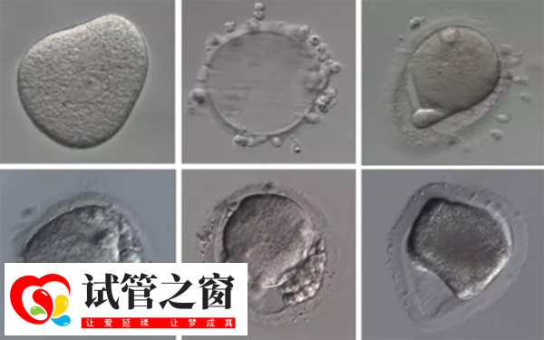 13b內膜做試管囊胚移植成功率在20%-30%