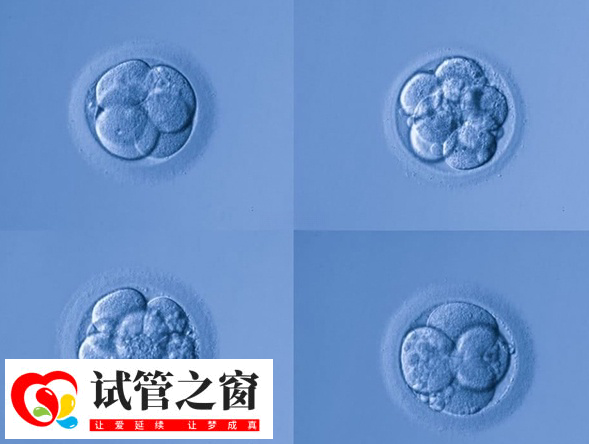 fet移植成功率一般在40%-60%左右