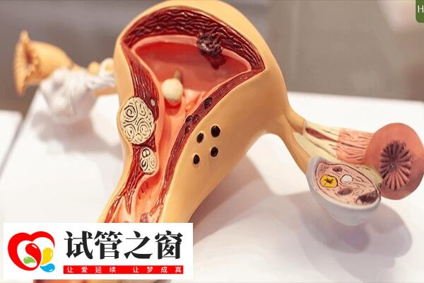 自然周期人工授精授精率大約10%-15%