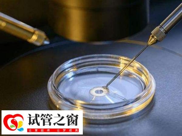 三代試管嬰兒涉及多個環節