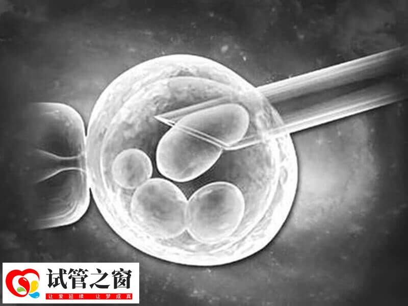取卵后要注意多休息
