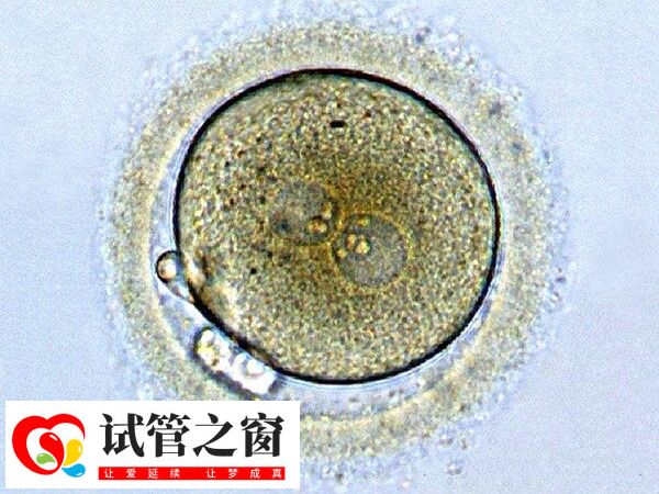 4BB囊胚移植成功率影響因素多