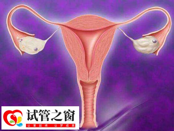 試管移植后子宮收縮會引起肚子痛