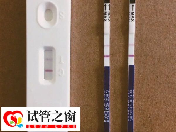 鮮胚移植是試管嬰兒中的一種助孕方法