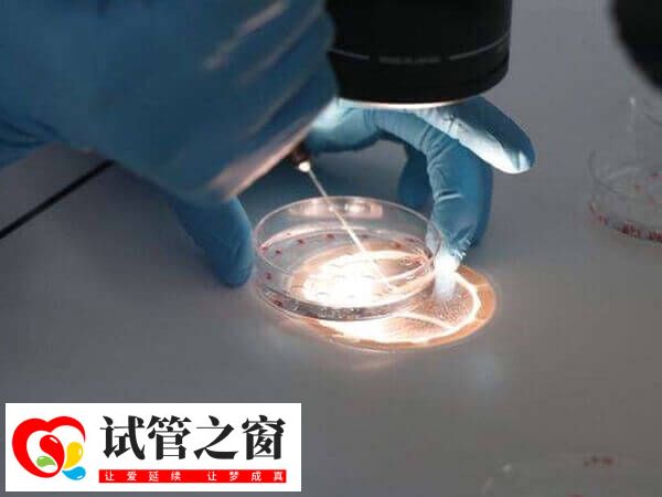 養囊的具體的費用會根據醫院收費標準而異