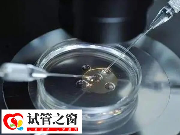 試管嬰兒就是將精子和卵子拿到體外結(jié)合