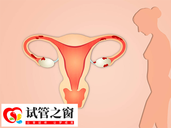 子宮內膜充血不能直接進行移植