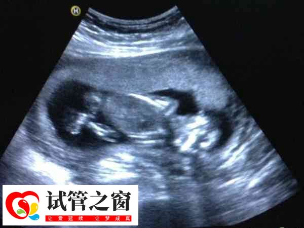 試管打夜針是一種促進(jìn)排卵的方式