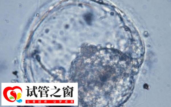 4cb囊胚確實(shí)屬于等級(jí)偏低的胚胎