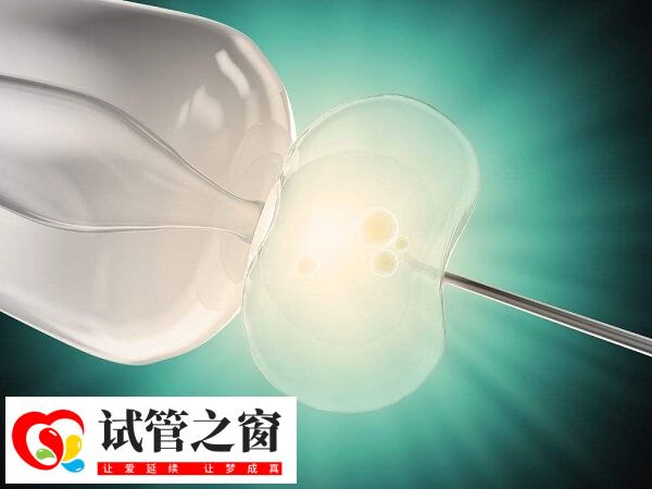 試管嬰兒移植是一個復雜的過程