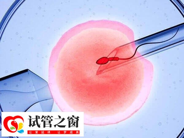 第四代試管技術研究方向