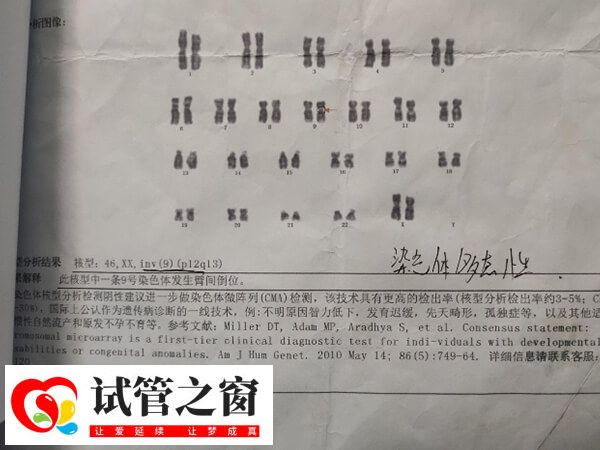 9號(hào)染色體是人類的23對染色體之一