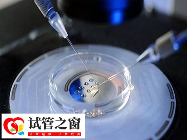 試管方案和試管移植的過程是不一樣的