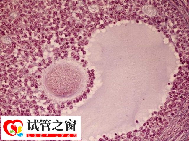 試管嬰兒也稱為體外受精-胚胎移植